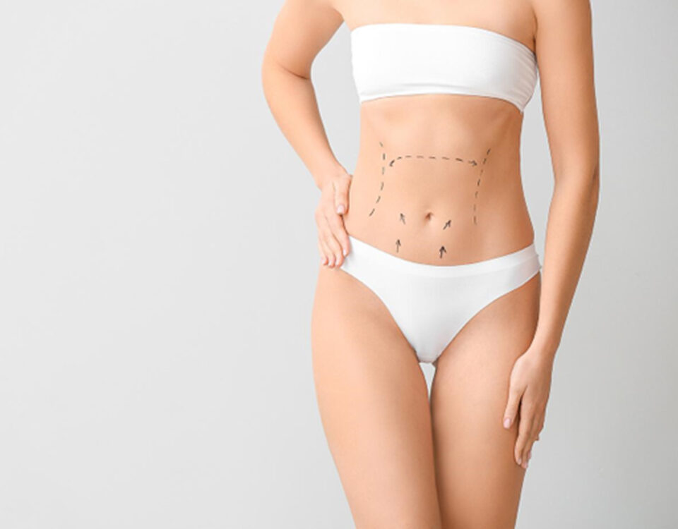 Tarif abdominoplastie avec sans liposuccion Tunisie