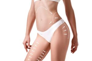 Chirurgie esthétique Tunisie mommy makeover