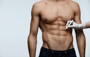 Chirurgie esthétique abdominal etching Tunisie