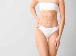 Prix chirurgie esthétique abdominoplastie avec liposuccion Tunisie