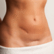 Est-il possible d'éviter la fibrose après une abdominoplastie ?
