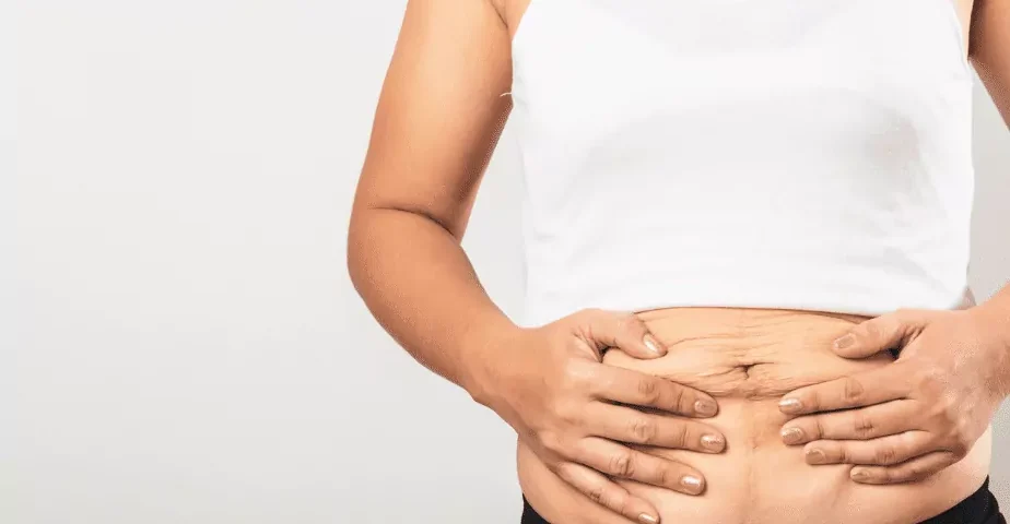 Comment remodeler son ventre après une grossesse ?