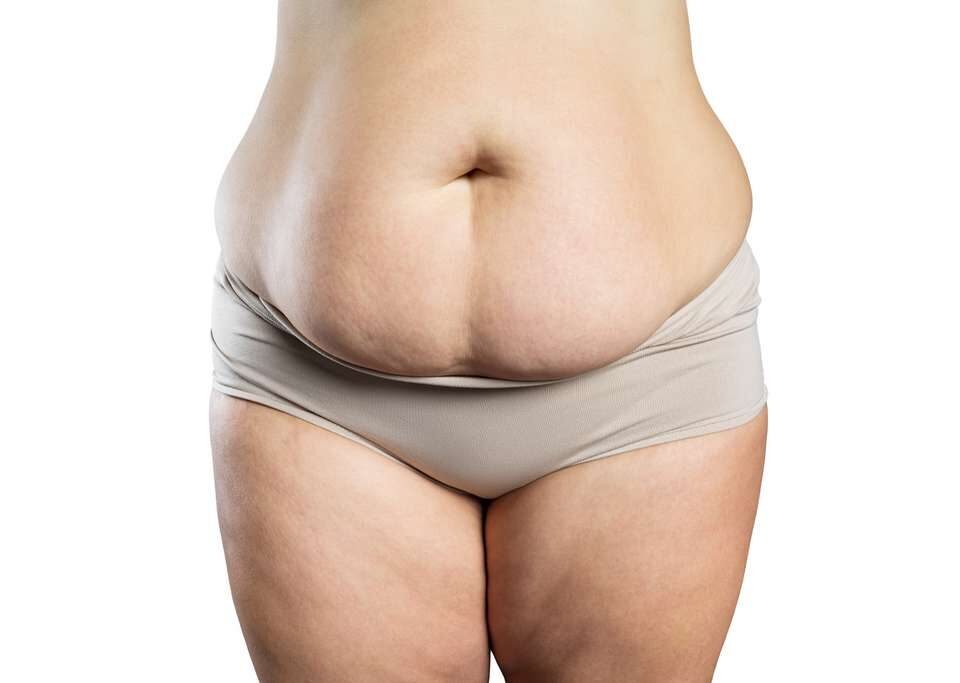 Est-il possible de perdre un ventre qui pend sans chirurgie ?