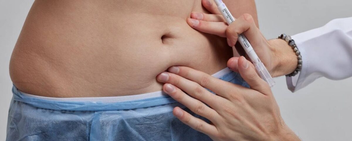 Quel est le traitement pour un épanchement lymphatique après une abdominoplastie ?