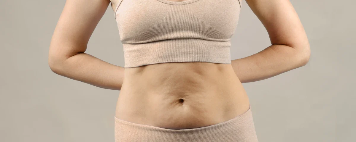 Est-il possible de retoucher une abdominoplastie ? Découvrez les solutions pour corriger une cicatrice trop haute, un nombril mal cicatrisé, un excès de peau ou un bourrelet persistent. Techniques, délais, risques, coûts et résultats : guide complet pour comprendre la retouche d’une abdominoplastie déjà réalisée.