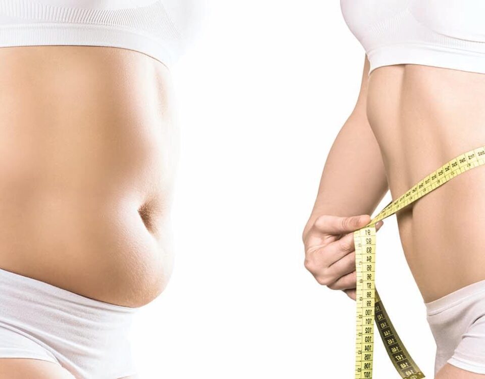 Body contouring du ventre