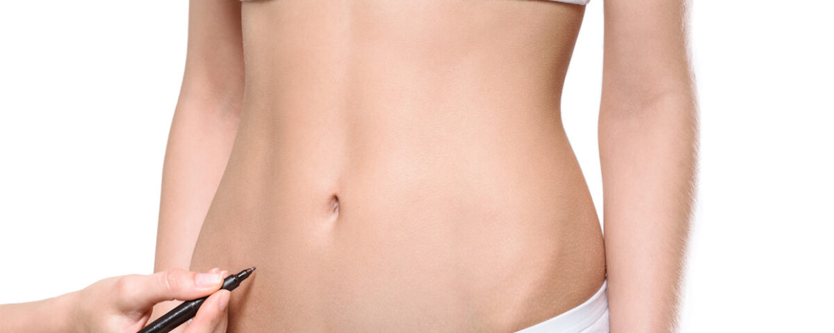 Liposuccion 4D en Tunisie