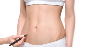 Liposuccion 4D en Tunisie