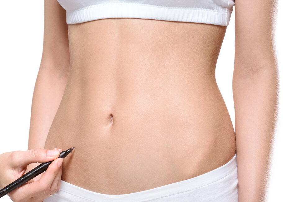 Liposuccion 4D en Tunisie