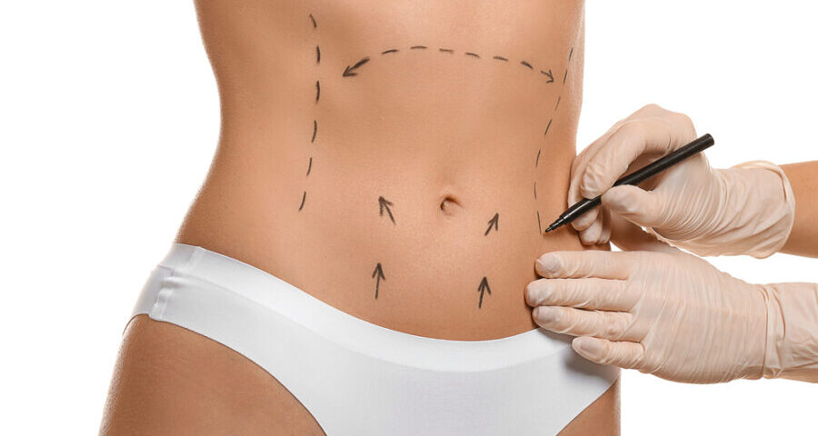 Liposuccion Haute Définition Tunisie