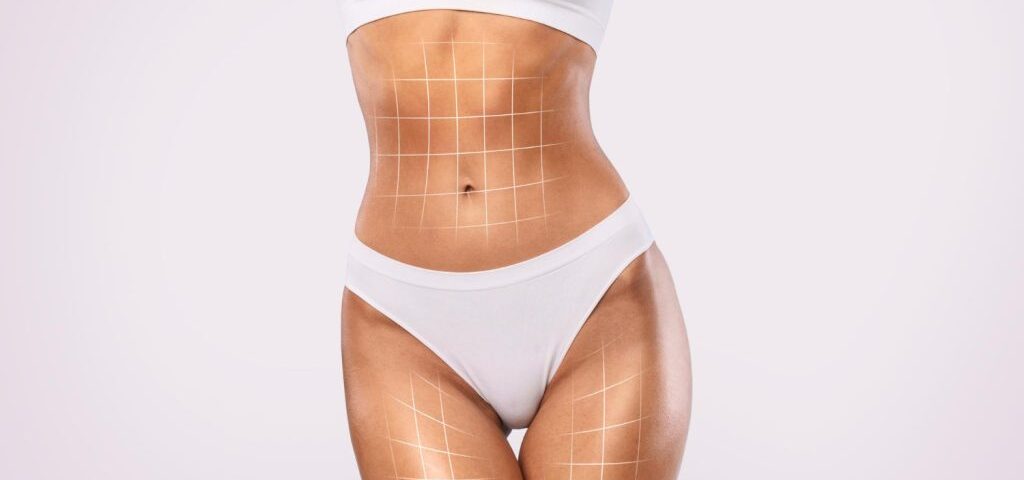 Abdominoplastie post-grossesse