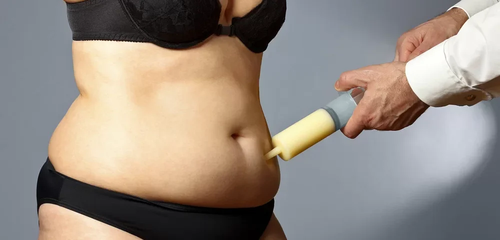 Abdominoplastie assistée par VASER