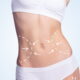 Lipoabdominoplastie